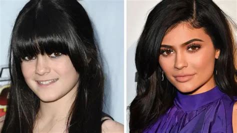 kylie jenner plastic surgery daily mail|Kylie Jenner addresses plastic surgery rumours in.